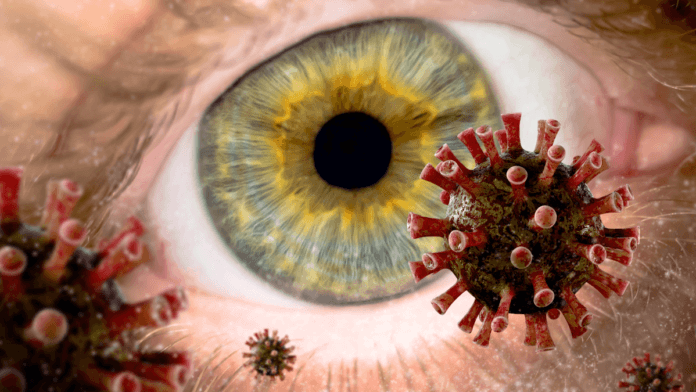 Eye Flu and Infection